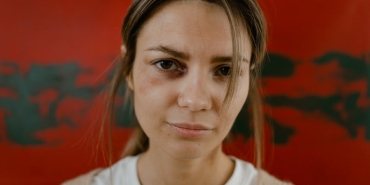 Usak8217ta-Sokak-Kopekleri-Dehseti-7-Yasindaki-Yusuf-Can-Yaralandi-featured